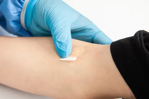 Ręka w niebieskiej rękawiczce zakłada plaster na ramię. Może to być związane z badaniem poziomu kortyzolu i jego objawami.