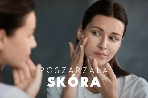 Kobieta z uwagą ogląda swoją poszarzałą cerę w lustrze, dotykając policzka.