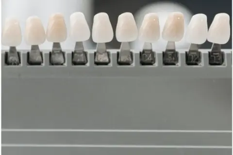 Muestras de dientes de diferentes tonos, para elegir el color perfecto y evitar la enfermedad de los dientes que se caen.
