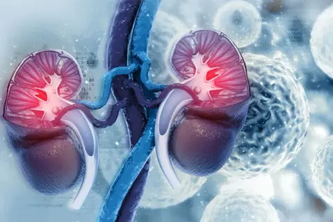 Anatomia nerki z podwyższonym GFR, sugerująca problemy z filtracją.