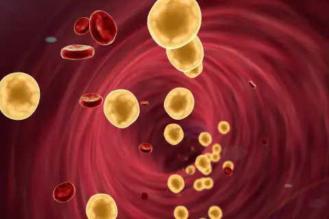 Jak obniżyć cholesterol na diecie keto? Skuteczne strategie i porady