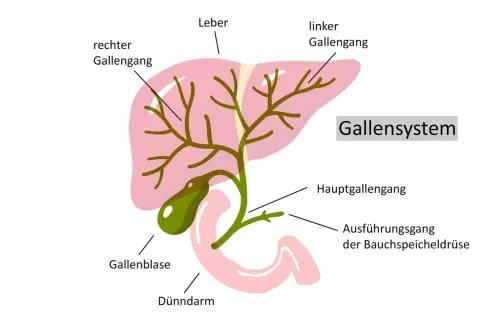 Schema des Gallensystems: Leber, Gallenblase, Gallengänge. Ein gallengang verstopft kann die lebenserwartung beeinflussen.