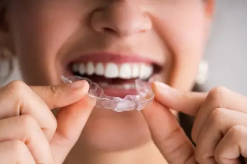 Dettaglio di una persona che tiene una mascherina trasparente, mostrando la differenza tra bite e mascherina per l'allineamento dentale.