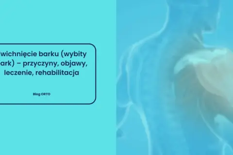 Zwichnięcie barku (wybity bark) – przyczyny, objawy, leczenie, rehabilitacja. Grafika przedstawia zarys ludzkiego ramienia z uwypuklonym stawem barkowym.