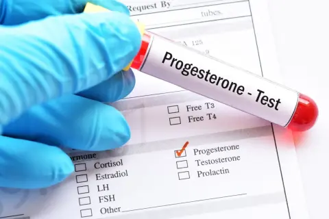 Rękawiczka w niebieskiej rękawiczce trzyma probówkę z napisem "Progesterone - Test". Zaznaczono pole "Progesterone" na formularzu.