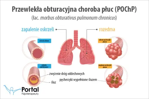 POChP a klimat: Gdzie szukać ulgi i jak oddychać lepiej?