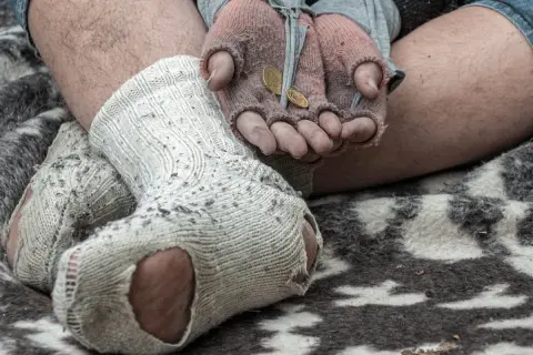 Dziurawe skarpety i dłonie z monetami. Czy to jest jałmużna, co to znaczy dla potrzebujących?