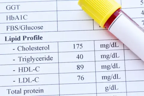 Wyniki lipidogramu pokazują poziom cholesterolu 175 mg/dL, co mieści się w normach cholesterolu. Obok leży probówka z krwią.