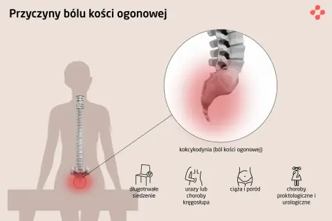 Ból kości ogonowej (kokcygodynia) może być spowodowany długotrwałym siedzeniem, urazami kręgosłupa, ciążą i porodem lub chorobami proktologicznymi.