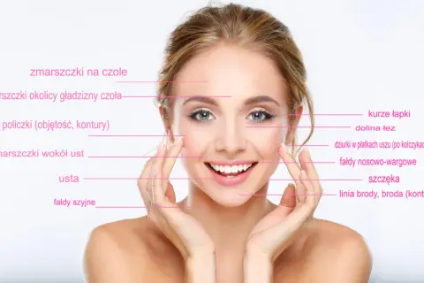 Uśmiechnięta kobieta z zaznaczonymi obszarami twarzy, gdzie można zastosować botox lub kwas hialuronowy na zmarszczki palacza i inne niedoskonałości.