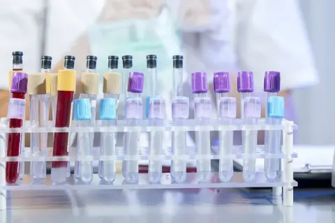 Jak uzupełnić niedobór sodu? Bezpieczne sposoby i sygnały alarmowe
