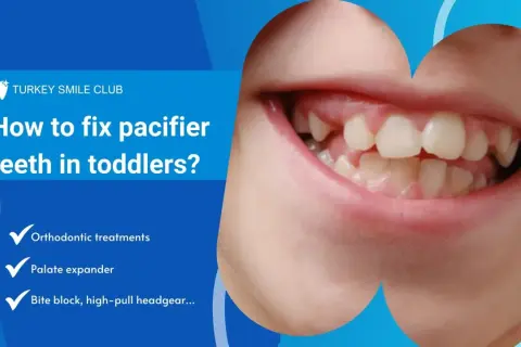 Close-up of a toddler's mouth showing misaligned teeth, likely due to pacifier use. Text discusses fixing pacifier teeth with orthodontic treatments.