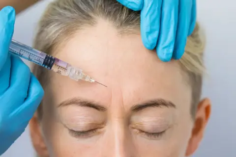 Zabieg baby botox na czole. Ręka w niebieskiej rękawiczce trzyma strzykawkę z igłą, która wstrzykuje preparat w zmarszczki mimiczne.