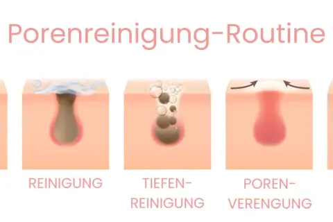Schritt-für-Schritt-Anleitung zur Porenreinigung: Entfernen von tiefsitzenden Mitessern durch Reinigung und Verengung der Poren für reine Haut.