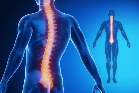 Schiena umana con colonna vertebrale evidenziata in arancione, che mostra un'ipercifosi lombare.