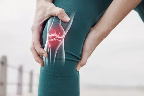 Schmerzendes Knie mit leuchtend rotem Meniskus, der auf eine mögliche Meniskus-OP hinweist.