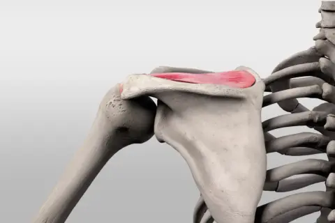 Schulterknochen mit hervorgehobenem musculus supraspinatus, der für die Armhebung wichtig ist.
