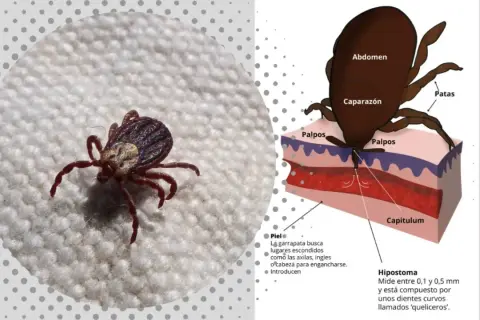 A qué temperatura mueren las garrapatas en la lavadora y cómo prevenir infestaciones