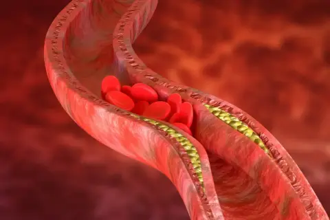 Cholesterol 240 czy to dużo? Sprawdź, jakie niesie zagrożenia