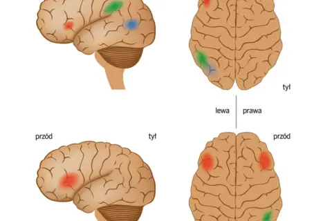 Co daje orzeczenie o dysleksji? Poznaj kluczowe korzyści dla ucznia