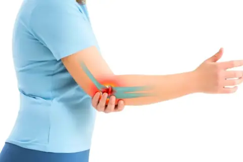 Une personne souffre d'une tendinite au coude, indiquée par une zone rouge. La glace peut aider à soulager la douleur.