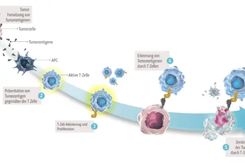 Schema der Immuntherapie: T-Zellen erkennen und zerstören Tumorzellen. Medikamenten-Namen sind hier nicht aufgeführt, aber der Prozess wird erklärt.
