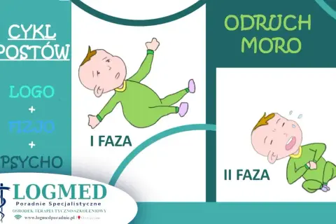 Ilustracja pokazuje dwie fazy odruchu Moro u niemowląt: I faza - dziecko wyciąga ręce i nogi, II faza - dziecko przyciąga kończyny do ciała.