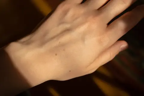 Dłoń z kilkoma niewielkimi, brązowymi plamkami, które mogą być interpretowane jako plamy wątrobowe na dłoniach.