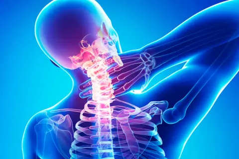 Menschlicher Nacken mit leuchtender Wirbelsäule, die auf Osteochondrosis intervertebralis hinweist.