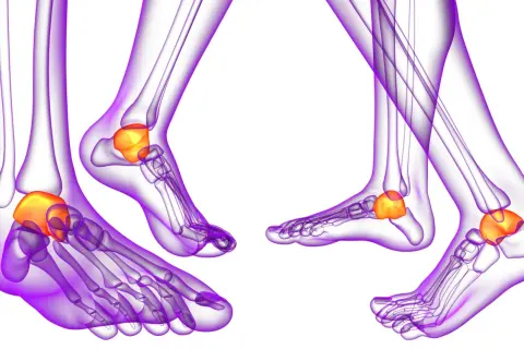 Anatomie du pied : vue latérale des os de la cheville, mettant en évidence le talus, un os clé de la malléole.