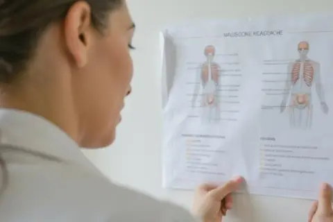 Lekarka analizuje schemat bólu głowy. Czy do neurologa potrzebne jest skierowanie? To pytanie nurtuje wielu pacjentów.