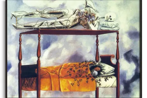 Frida Kahlo's "Henry Ford Hospital" depicts her in bed, connected to a fetus by umbilical cords. A skeleton rests above, symbolizing death.