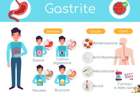 Illustrazione sulla gastrite cronica: sintomi (dolore, cattiva digestione, nausea, bruciore), cause (alimentazione, antinfiammatori, Helicobacter P, alcool) e cura (farmaci, dieta sana).