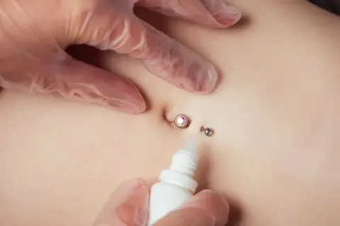 Dłoń w rękawiczce aplikuje płyn na świeży piercing pępka z błyszczącym kamieniem.