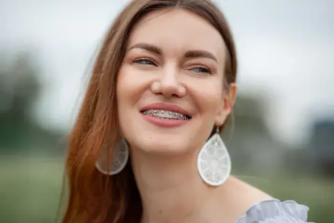 Sorriso smagliante con apparecchio, dimostrando che l'ortodonzia a 50 anni è una scelta di benessere e bellezza.