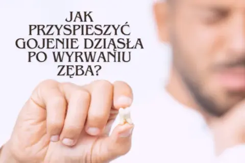 Jak przyspieszyć gojenie dziąsła po wyrwaniu zęba i uniknąć bólu