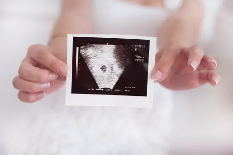 Czy w 5 tygodniu lekarz potwierdzi ciążę? Co warto wiedzieć?