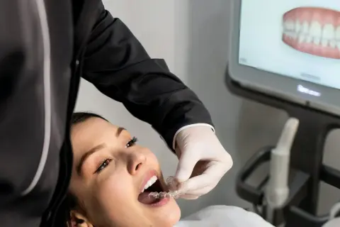 Dentysta pomaga pacjentce z kruche zęby jak wzmocnić, zakładając jej przezroczysty aparat ortodontyczny. Na ekranie widać wizualizację uzębienia.