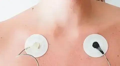 Holter EKG: Czy diagnozuje nerwicę serca? Odpowiedź eksperta
