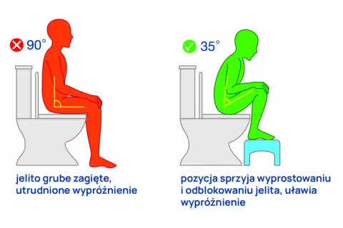 Tenesmus i parcie na stolec: Jak odzyskać komfort? Przyczyny i leczenie