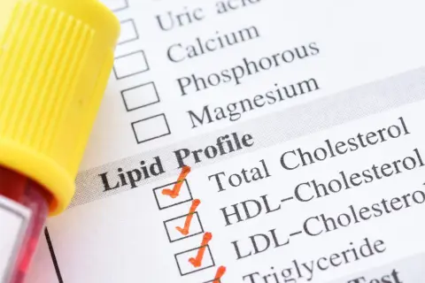 Próbka krwi i formularz Lipid Profile. Wyniki badania pomogą ustalić, co podwyższa cholesterol.