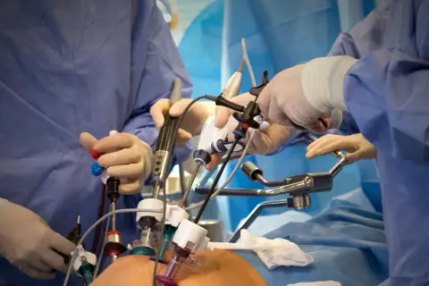 Chirurgen führen eine minimalinvasive Prostata-OP durch. Hände in Handschuhen bedienen feine Instrumente, die durch kleine Schnitte eingeführt werden.
