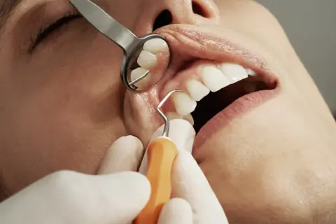 Ile trwa wizyta u dentysty? Czas zabiegów od A do Z