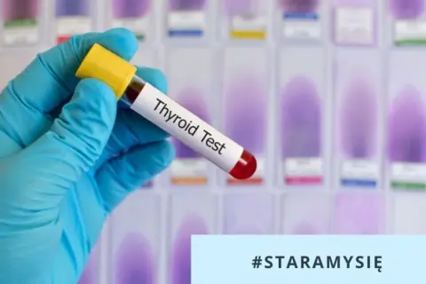 Rękawiczka trzyma probówkę z krwią do badania tarczycy. Czy wynik TSH robi się na czczo? #staramysię