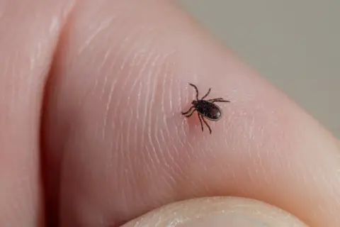 Mały kleszcz na ludzkim palcu. Zastanawiasz się, czy kleszcz skacze? Ten mały pajęczak nie skacze, ale potrafi szybko się poruszać.