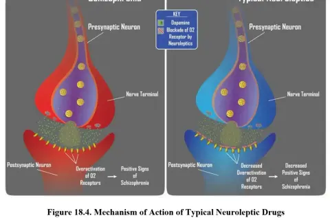 Schemat działania neuroleptyków: schizofrenia (nadaktywne receptory D2) vs. typowe neuroleptyki (blokada receptorów D2).