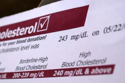 Jak oznaczony jest cholesterol na wynikach? Zrozum swoje wyniki zdrowotne