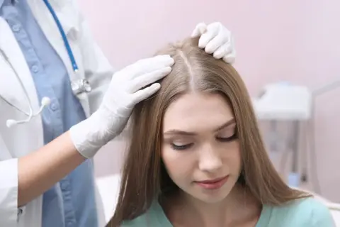 Lekarz w białej rękawiczce bada skórę głowy pacjentki. Czy potrzebuję skierowanie do dermatologa?