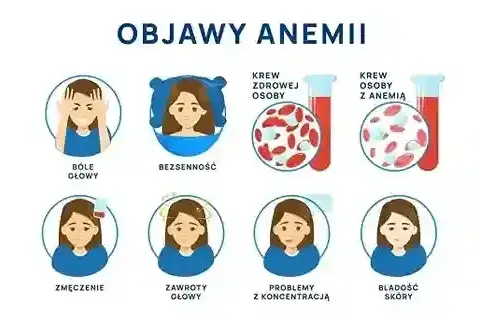 Zmęczenie, apatia, lęk? To może być niedobór żelaza! Jak leczyć?