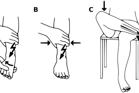 Ilustracje A, B, C pokazują zastosowanie zasady PRICE w leczeniu urazów: P - ochrona, R - odpoczynek, I - lod, C - ucisk, E - elewacja.